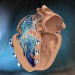 Right heart