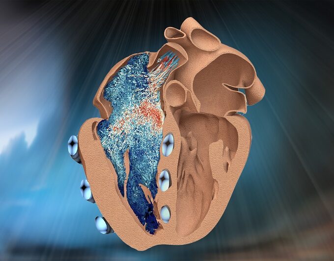 Right heart
