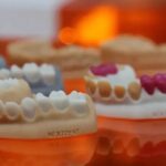 3D Printing Dentures 2