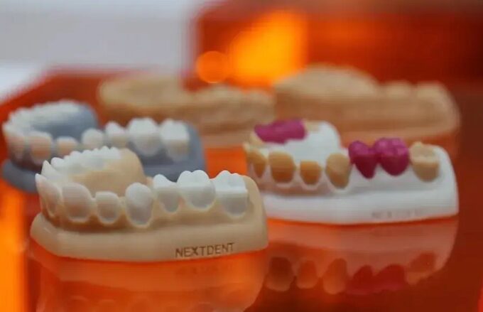 3D Printing Dentures 2