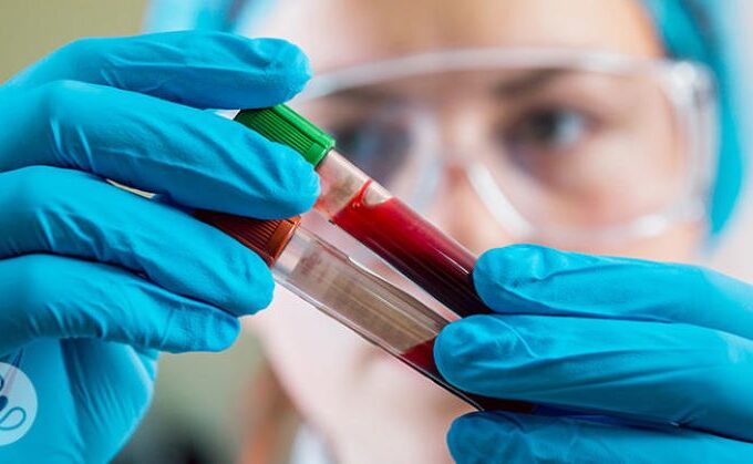 Blood contains a huge amount of information