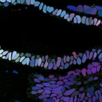 Research on gastric cysts